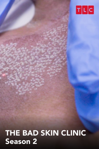 The Bad Skin Clinic (S2)